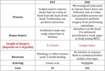 Choosing the best hair transplant method|Strip Surgery|FUE