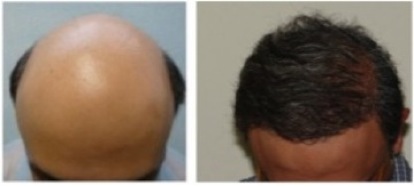 grow hair Grow Hair
