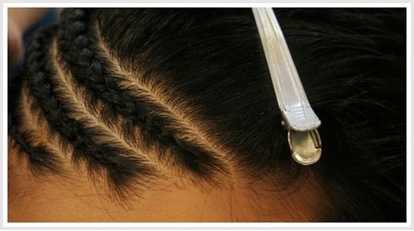 Traction Alopecia |corn rows|tight braiding