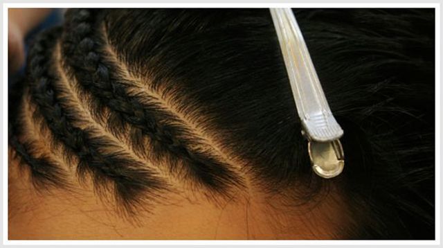 hair loss african american women |tight hair styling practices hair loss african american women |tight hair styling practices