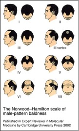 Hair Transplant Images|Hamilton Norwood Scale 