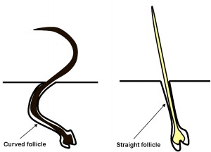 Hair Loss Transplantation for Asians with FUE - Cross sectional diagram of straight versus curved hair follicles