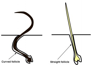 Hair Type and Hair Loss in Ethnicities, Part 1