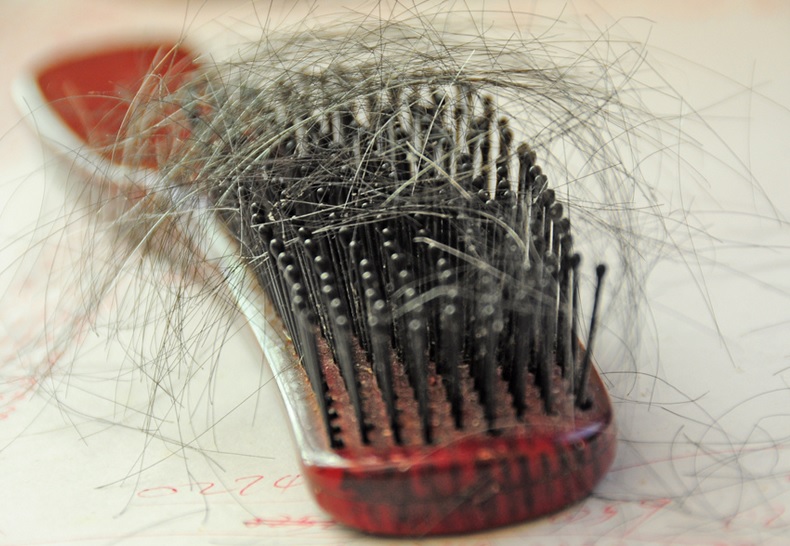 Hair Loss Diagnostic Methods: How Is Hair Loss Diagnosed ?