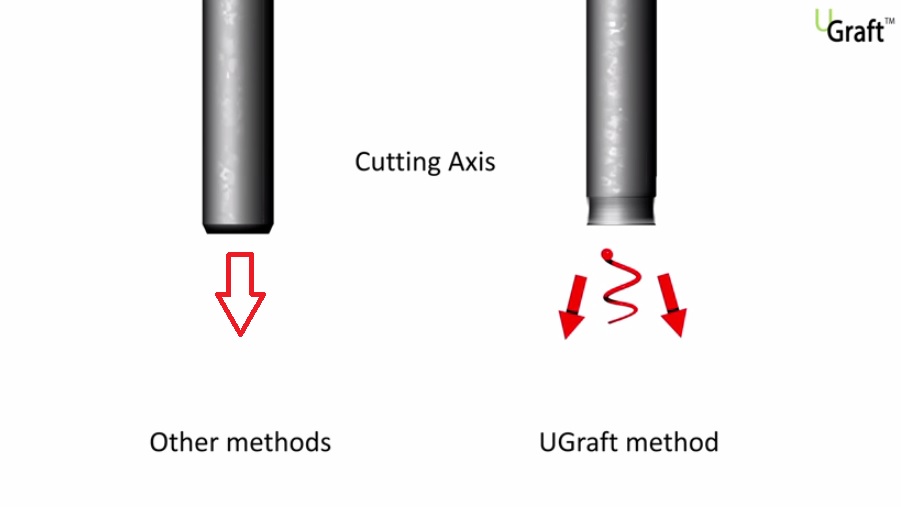 Patented away pointing cutting axis and gentle pulling force. UGraft Punch Compared to Regular FUE Punch
