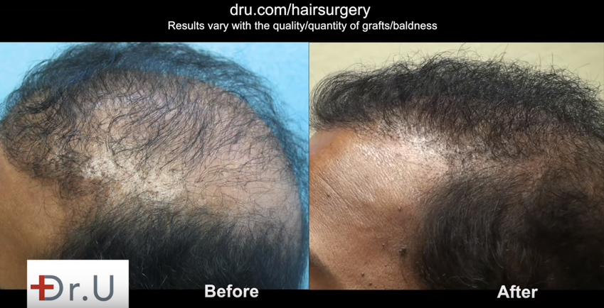 https://www.dermhairclinic.com/wp-content/uploads/2015/10/dm_beforeafter2.png