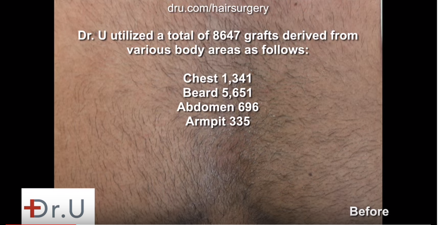 https://www.dermhairclinic.com/wp-content/uploads/2015/10/dm_grafts.png