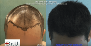 patient results