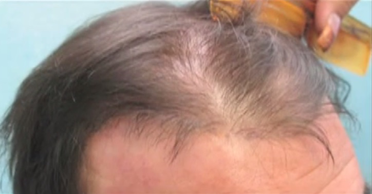 Example of Juri Flap Results